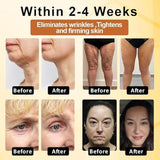 Botox Bee Advanced Multi-Action Firming Cream 100 gm Pack of 1